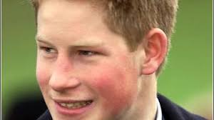 Pot Puts Prince Harry In Hot Water