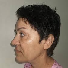 Operaciones Estambul