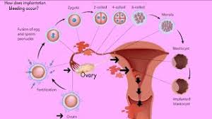 The frequency and duration of breakthrough bleeding can vary and depend on many factors. Bleeding During Pregnancy Implantation Bleeding How Long Does Implantation Bleeding Last Youtube