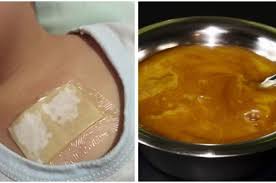 Check spelling or type a new query. Tanpa Obat Inilah Cara Meredakan Batuk Dan Menghilangkan Dahak Dalam Semalam
