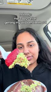 Wisdom Terth Removal Day 3