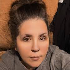 Ground Turkey Ingredients and Seizure Triggers in Dogs