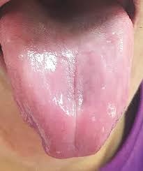 We did not find results for: Pensioner S Taste Buds Disappear Due To A Blood Condition Daily Mail Online