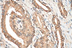 Mitsubishi is leaving the uk, and while we won't miss the mirage all that much, it's yet another reminder. Puma Antibody 55120 1 Ap Proteintech