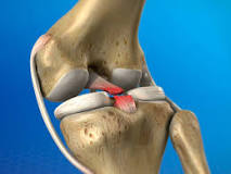Ligamento cruzado posterior (LCP) - Dr. Pedro Giglio