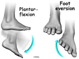 Moderate to severe pain in the ankle and foot with ambulating or running or in fact any movement of the foot. Conditions And Treatments