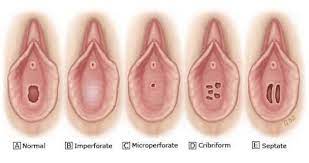 If you do have a hymen, you probably can't see or feel it it's basically impossible to see your hymen yourself, even if you're using a mirror and a flashlight. Things You Didn T Know About Hymens The Safer Sex Fairy