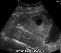 Kidneys Sonography Folder Ultrasound Sonography Sonography Sonography School