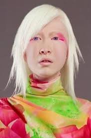 Albinism Is A Condition In Which A Person Has An Often Complete Lack Of Pigment In Their Skin Hair And Eyes In Not Only Occurs Albino Human Albino Albinism