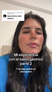 Mi experiencia con el balón gástrico parte 2