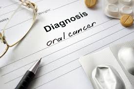 This type of care is called palliative care. Oral Cancer Signs Diagnosis Treatment