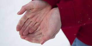 Check spelling or type a new query. Esclerodermia Sintomas Tratamientos Causas E Informacion