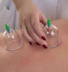 Stop Worrying And Start Healing With The Effective Hijama Remedy That We Provide In Your City Chennai Mannad Ventosaterapia Dicas De Massagem Massoterapia