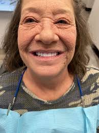 Special Offer*** Full Mouth Dental Implants . Limited offer Phone #  (832)705-3321 thedentalimplantdoctor@gmail.com www.Newmedental.com Full  mouth top and bottom dental implants . and extractions INCLUDED. I.V.  Sedation included Zirconia permanent teeth ...