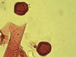 Image result for Antrocaryon