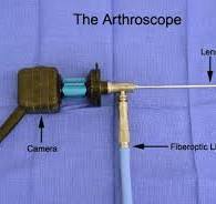 Knee Arthroscopy - Advanced Orthopaedic Associates