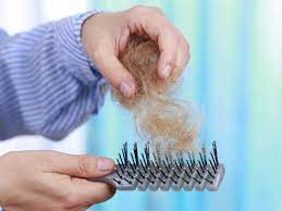 Hair loss in men can occur at any age. How Much Hair Loss Is Normal These Statistics Are Real