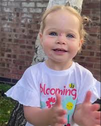 We Got Stares'', Parents Choose to Remove Baby Girl's Rare Birthmark to  Avoid Rude Reactions