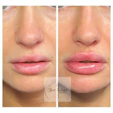 Photo by Lacy Chapman (@aestheticrn.lacy) · May 15, 2024