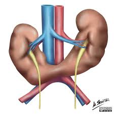 Horseshoe Kidney Illustration Radiology Case Radiopaedia Org Medical Ultrasound Radiology Diagnostic Medical Sonography