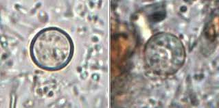 Image result for Cyclospora