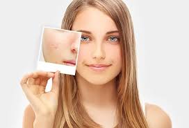 Image result for red rash face