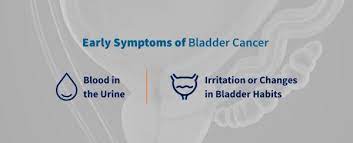 Lymph nodes are groups of immune system cells about the size of beans. A Detailed Look At Bladder Cancer Symptoms Cxbladder