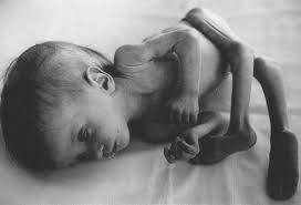 Auch bei tieren und pflanzen werden diverse missbildungen festgestellt. Atomenergie