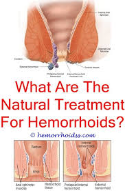 Pin On Stop Bleeding Hemorrhoids