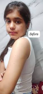 What are some alpha-gal friendly body wash options?