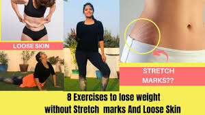 In general, a young person who loses less than 30% of their weight won't have a problem with loose skin. 8 Exercises To Lose Weight Without Loose Skin Stretch Marks After Weight Loss Somya Luhadia Youtube
