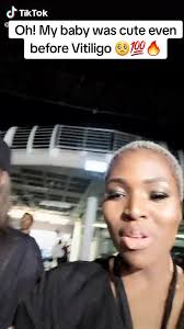 Yolanda Mukondi's Inspiring Beauty Transformation