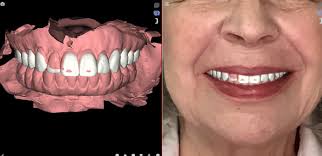 Dive into integrating digital dentistry to your practice! Dr. Francis  Paraiso! Here's the zoom link  [https://zoom.us/j/98158850786](https://zoom.us/j/98158850786) Meeting ID:  981 5885 0786