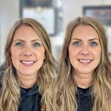 Madison Wellness & Aesthetic Center, 844 Slaughter Rd, Ste A, Madison, AL  35758, US