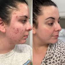 Instagram video by Casie & Jonny Thibodeaux • Jun 20, 2025 at 12:57 PM