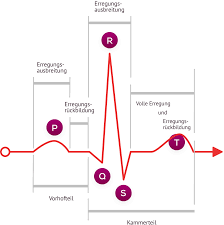 Subscribe to litfl via email. Diagnose Herzinsuffizienz Ekg Verstehen Www Herzbewusst De