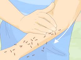 Image result for Fire Ant Sting