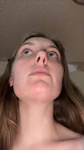 What causes alcohol sensitivity and how to determine if it's the cause?