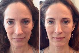 More Than A Decade Ago Exercise Physiologist Sue Hitzmann Developed A Quick Self Massage Series On The Face And Neck To Face Massage Perfect Skin Simple Face