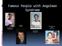 Ppt Angleman Syndrome Powerpoint Presentation Free Download Id 2640846