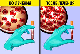 10 Neochevidnyh Prichin Iz Za Kotoryh Postoyanno Hochetsya Spat
