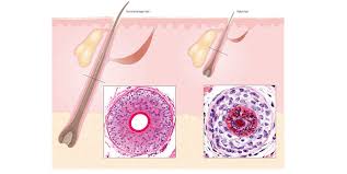 Diseases Of The Hair Basicmedical Key
