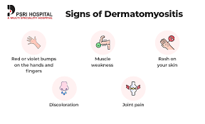 Image result for Dermatomyositis
