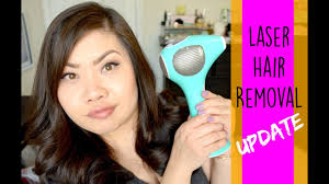 Tria hair removal laser 4x arrived. Laser Hair Removal Update Before After Youtube
