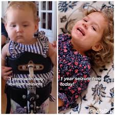 Emery wanted to say hello to everyone in her Hemi group! She is 3 months  post op and doing great ❤️ The surgery also helped us determine she's  seeing more than we