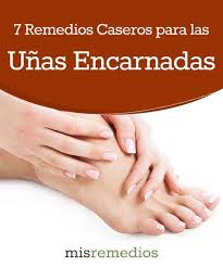 Pin On Remedios