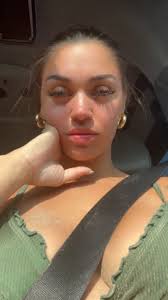 Pictures of Damien and Bianca