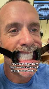 Temecula Dental Implants