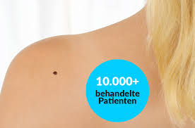 Das maligne melanom ist für > 90% aller sterbefälle an hauttumoren verantwortlich. Das Maligne Melanom Bodensee Laserklinik Dr Martin Braun Hautarzt Uberlingen