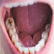 Decayed Teeth Treatment product image